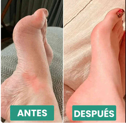 ComfortStep™ | Reduce el Dolor al Caminar y Llévate 2 por 1